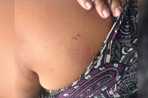 Mulher é agredida pela namorada após surto de ciúmes em Rio Verde