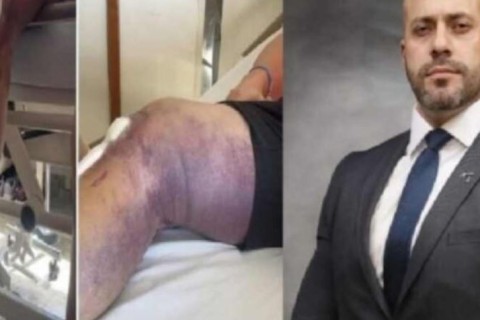 ‘Pelo amor de Deus’, médico de Daniel Silveira implora para levá-lo ao hospital onde fez a cirurgia