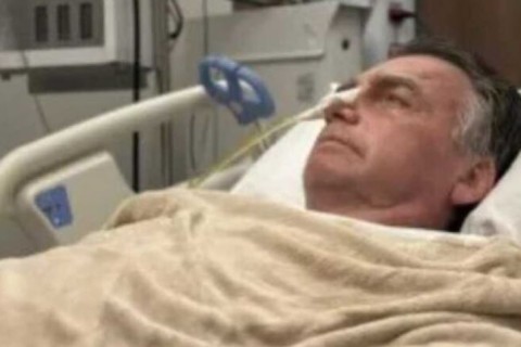 Bolsonaro sofre traumatismo craniano após queda dentro da PF